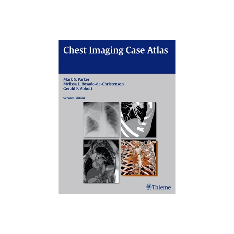 Chest Imaging Case Atlas - 2nd Edition